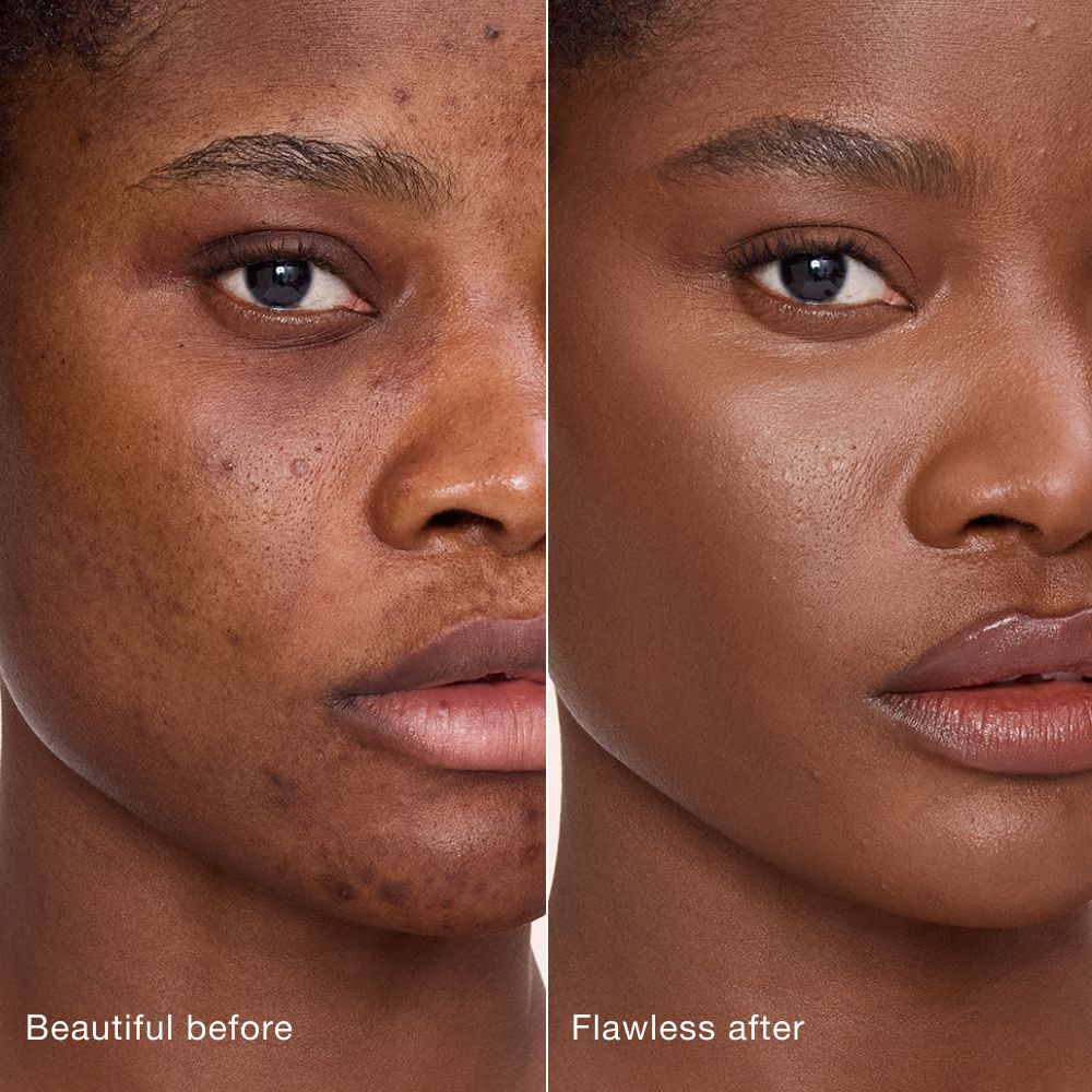 Side-by-side comparison showing skin before and after applying Charlotte Tilbury Airbrush Flawless Concealer, with text labels 'Beautiful before' and 'Flawless after'.