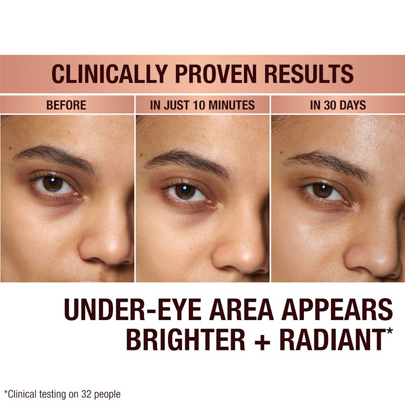Before and after results of Shakira using Immediate Eye Revival Patches to reduce dark circles under eyes