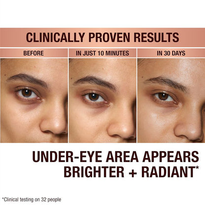 Before and after results of Shakira using Immediate Eye Revival Patches to reduce dark circles under eyes