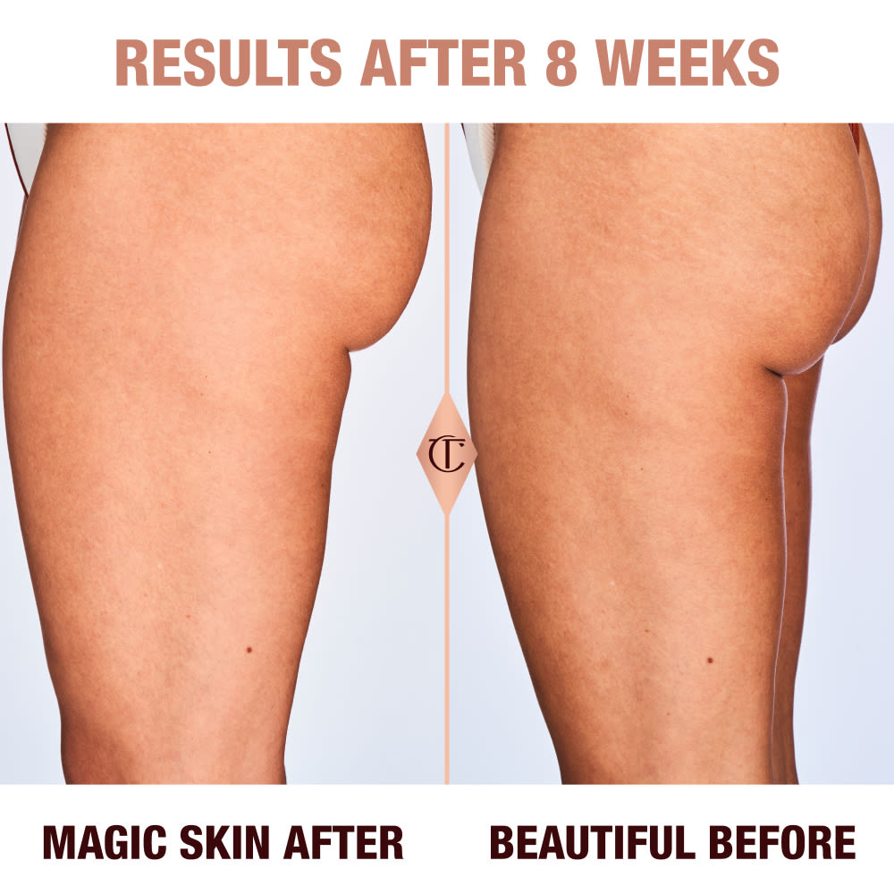 Results of Magic Body Cream after 8 weeks on a medium skin tone model