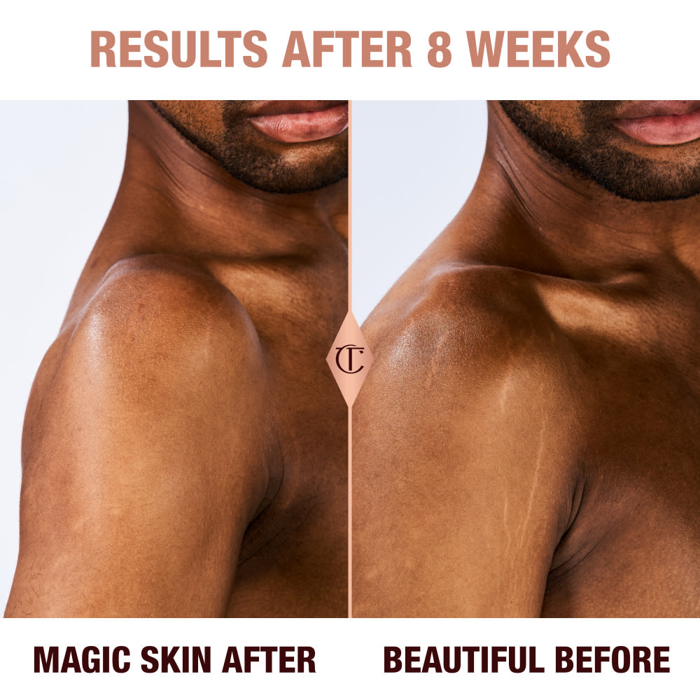 Results of Magic Body Cream after 8 weeks on a deep skin male model