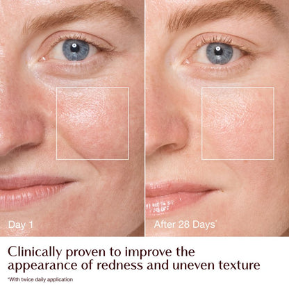 Magic Cream - before and after redness + texture infographic - model Emily