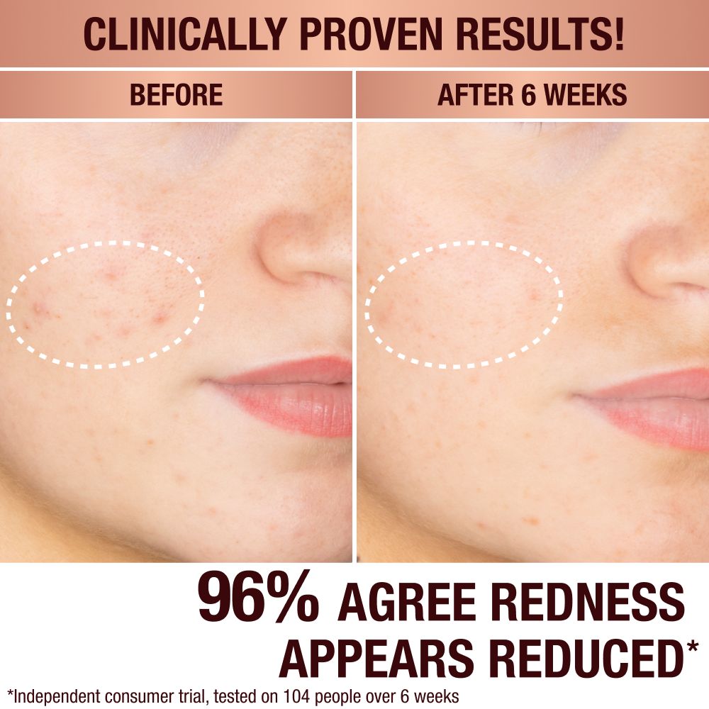 Charlottes Dark Spot Serum