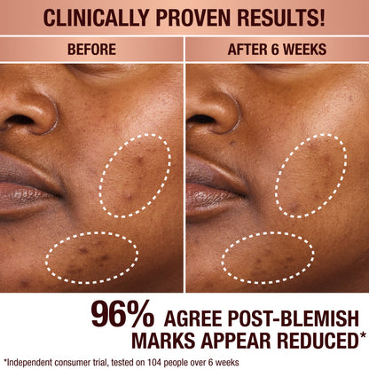 Charlottes Dark Spot Serum