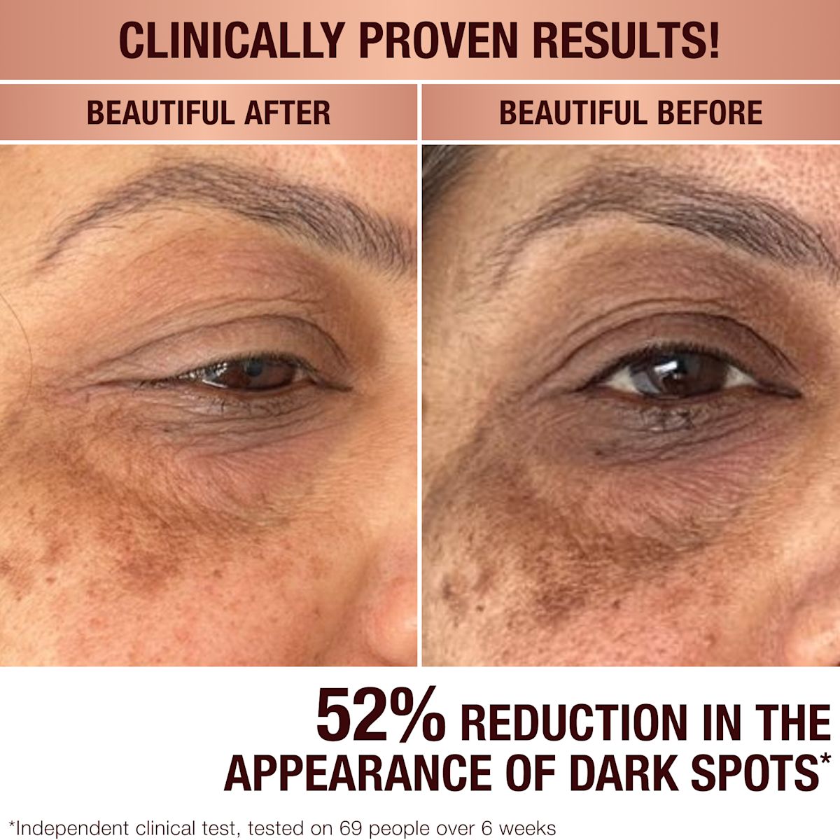 Charlottes Dark Spot Serum