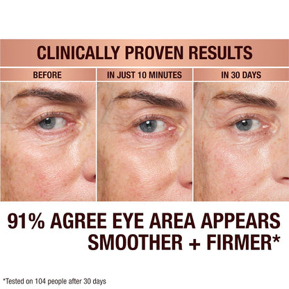 Model before and afters from wearing Immediate Eye Revival Patches to reduce eye bags